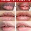 Bálsamo Labial Kormesic Hidratante Reparador 10g