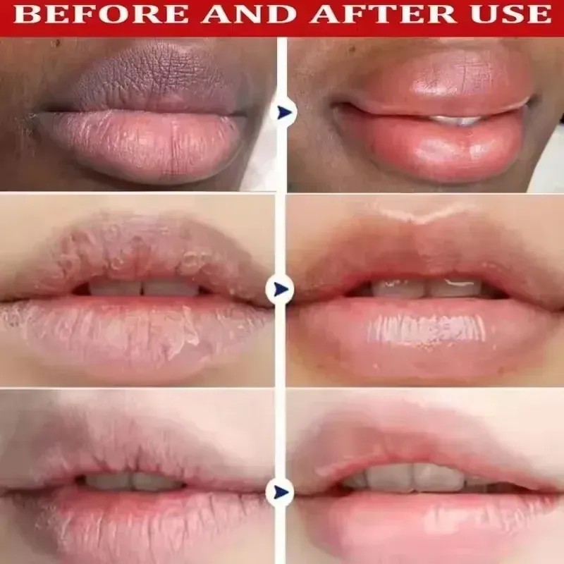 Bálsamo Labial Kormesic Hidratante Reparador 10g
