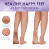 2 Pairs Foot Mask, Callus Socks, Dead and Effectively Removes