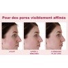 Sérum De Ácido Azelaico 20 G, Reduce Las Imperfecciones