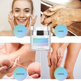 Elvanya Dark Spot Remover for Face, Age Spot Remover, Dark Spot Corrector, Melasma Treatment for Face Brightening Sun Spot Faded Cream for Body, for Skin, 1.7 fl oz