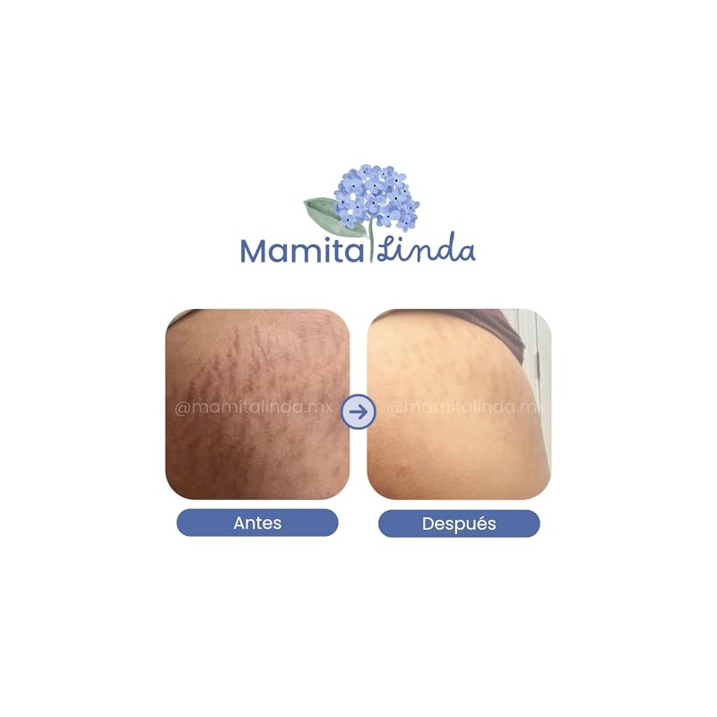 Mamita Linda Pócima Ancestral Posparto | Recuperación Natural, Desinflama y