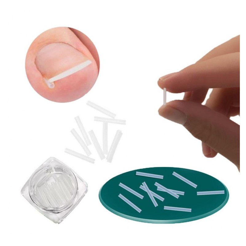 Pingshow86 Self Curve Stick Toenail U-Shaped Care Nail Care Problematic