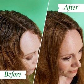 PHILIP KINGSLEY Flaky Scalp Shampoo for Flaky Dry, Oily Scalps Cleansing Scalp Care Hair Products Soothing, Soothes and Calms, 8.45 oz.