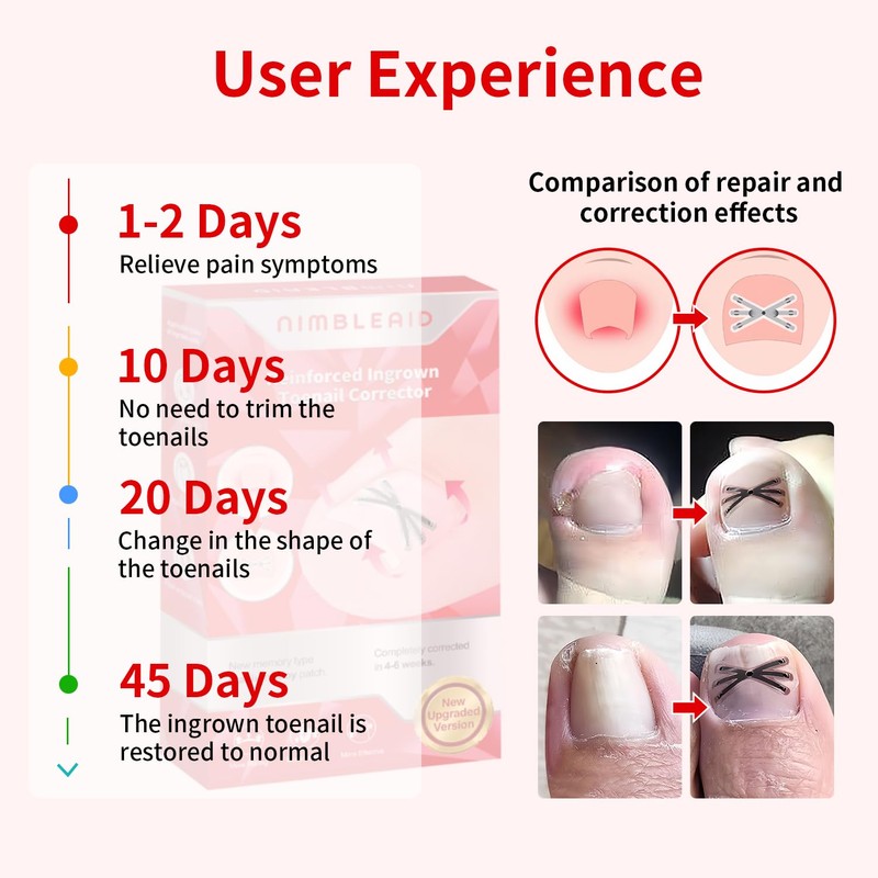 Upgraded Titanium Alloy Ingrown Toenail Corrector with Upgraded 6-Angle Shape,3x