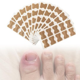 Ingrown Toenail Corrector Patch, 100 Pcs, No Glue & Breathable, 0.5"Wx0.7"L