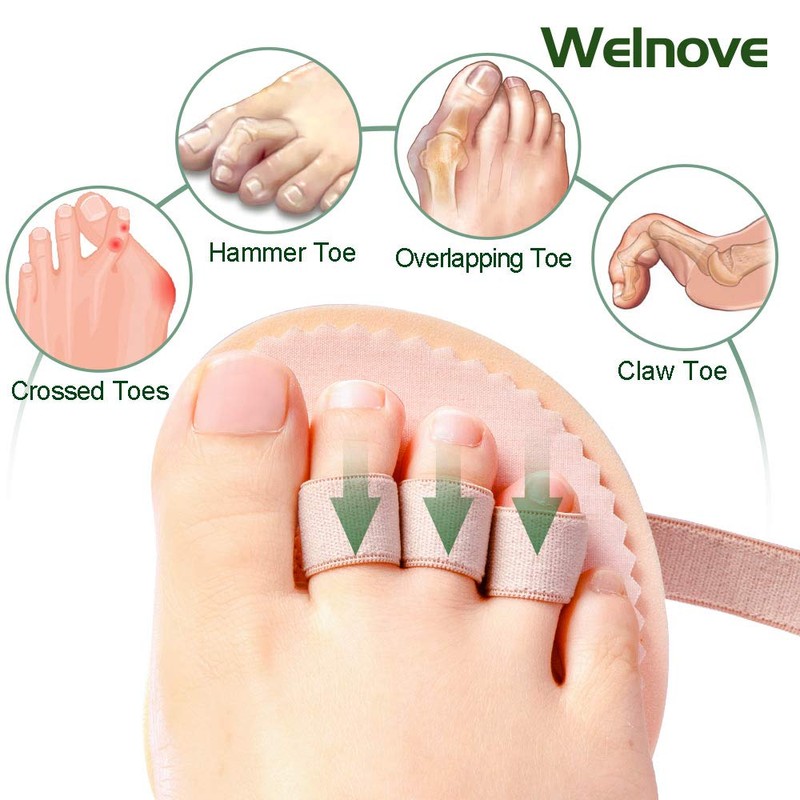 Welnove - Toe Straightener Hammer Toe Hallux Varus Mallet Overlapping