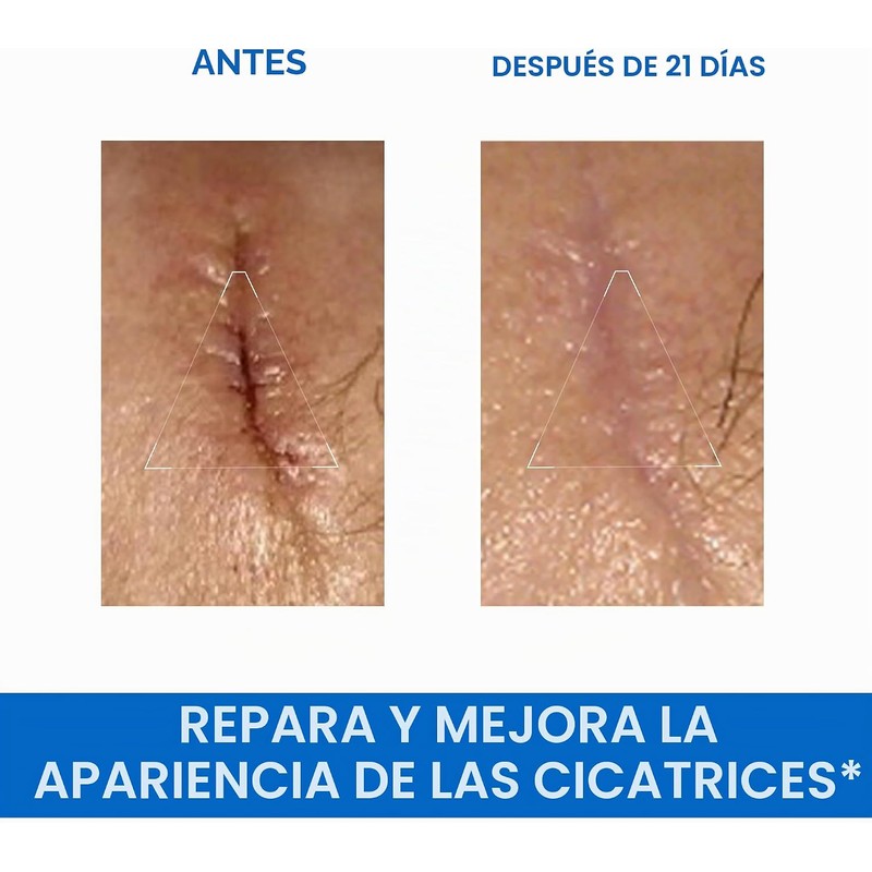 Uriage Bariederm-Cica Crema Reparadora