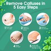 DeEnti Callus Maintenance Pack, Bundle Includes Mint Scented Callus Remover,
