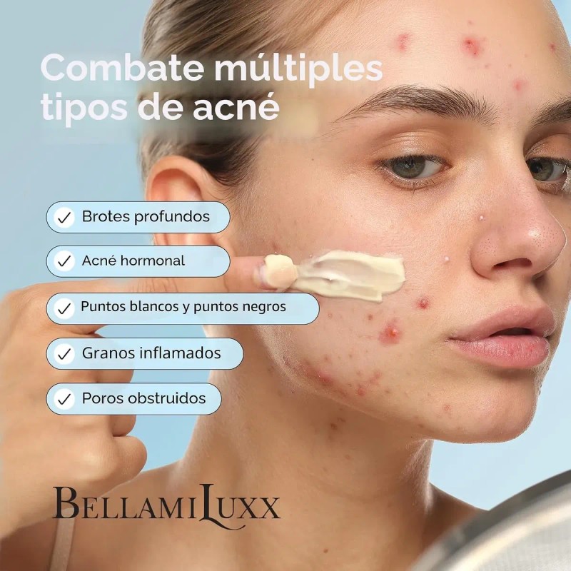 Bellamiluxx Set Tratamiento Para Acné Facial Y Corporal 2pz