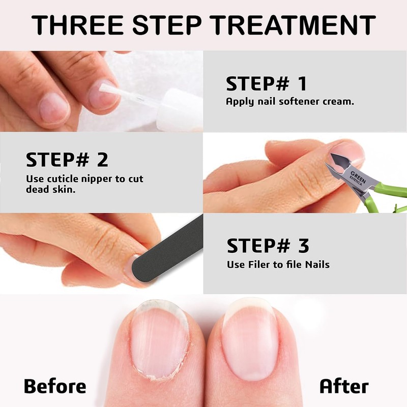 Professional Cuticle Trimmer Nail Cuticle Cutter Stainless Steel Cuticle Nippers