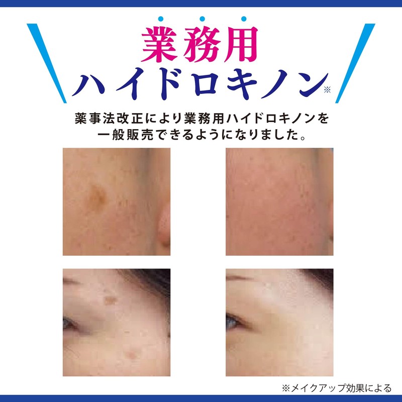 Asahi Research Institute Professional Hydroquinone 5% Cream Large Capacity 15g