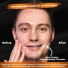 Men's Skincare Men's Facial Kit Complete Routine - Facial Cleanser