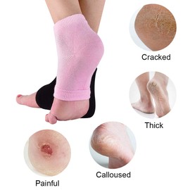 Moisturizing Socks, Gel Heel Socks, Toe Open Socks, Relieve Heel Pain Comfortable Soft Vented Moisturizing Socks Suitable for Male and Female Day Night Care Skin Dry Cracked High Heel, 2 Pairs