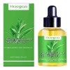 Aceite Capilar De Romero Hoegoa Para El Tratamiento Del Cuid