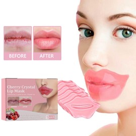 Collagen Crystal Lip Mask Set, Lip Mask Set, Lip Masks, Moisturising Nourishing Lip Plasters, Cherry Lip Mask Pads, Filling Masks for Lips, 5 Pieces