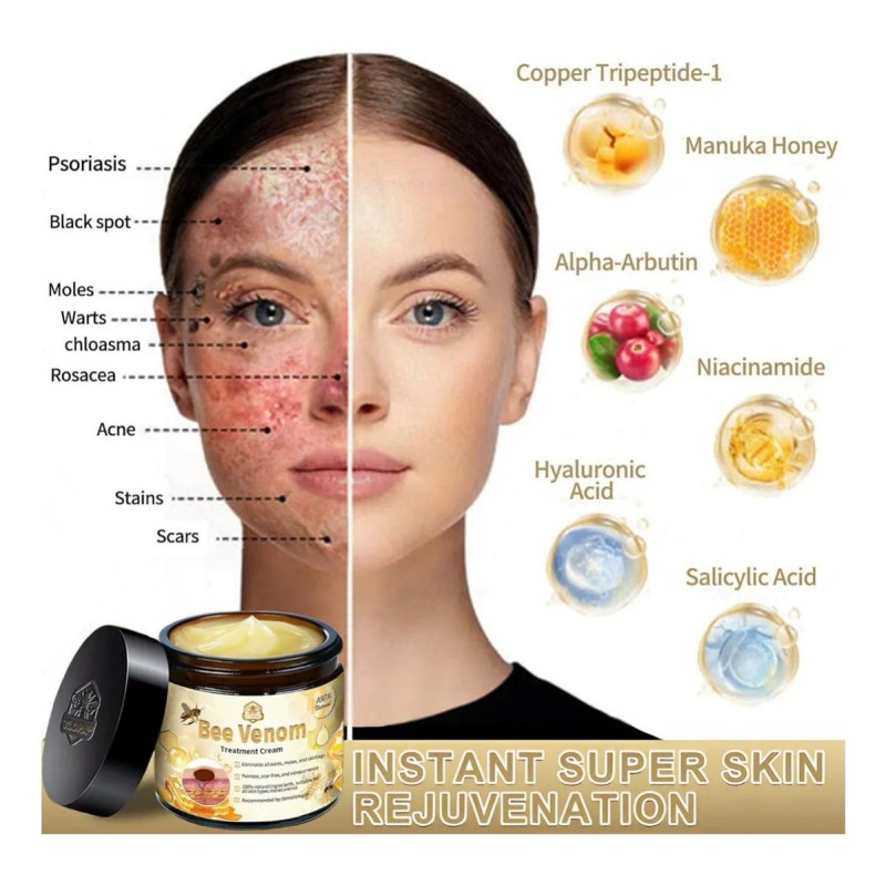 Crema De Tratamiento Para La Piel De Abeja, All Parts