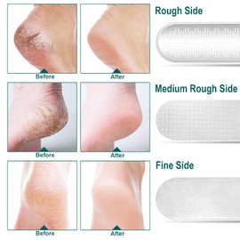 Foot File Pedicure Foot File 3 in 1 Foot File with 3 Sides Horn Remover Pedicure Tool Cracked Feet Wet or Dry Remove Dead Skin