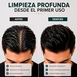 El español con stylo - Shampoo Artesanal Alquitran de hulla - Anticaspa - efecto depurativo.