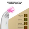 Electric 4‑In‑1 Blackhead Removal Pore Cleaner Suction USB Charging Face