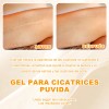 Crema Eliminar Cicatrices Gel Depara Reparar