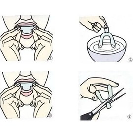 2 Piezas Guarda Dental Protector Bucal Bruxismo Dental Desgaste Dental Guardas Dentales Gel Moldeable