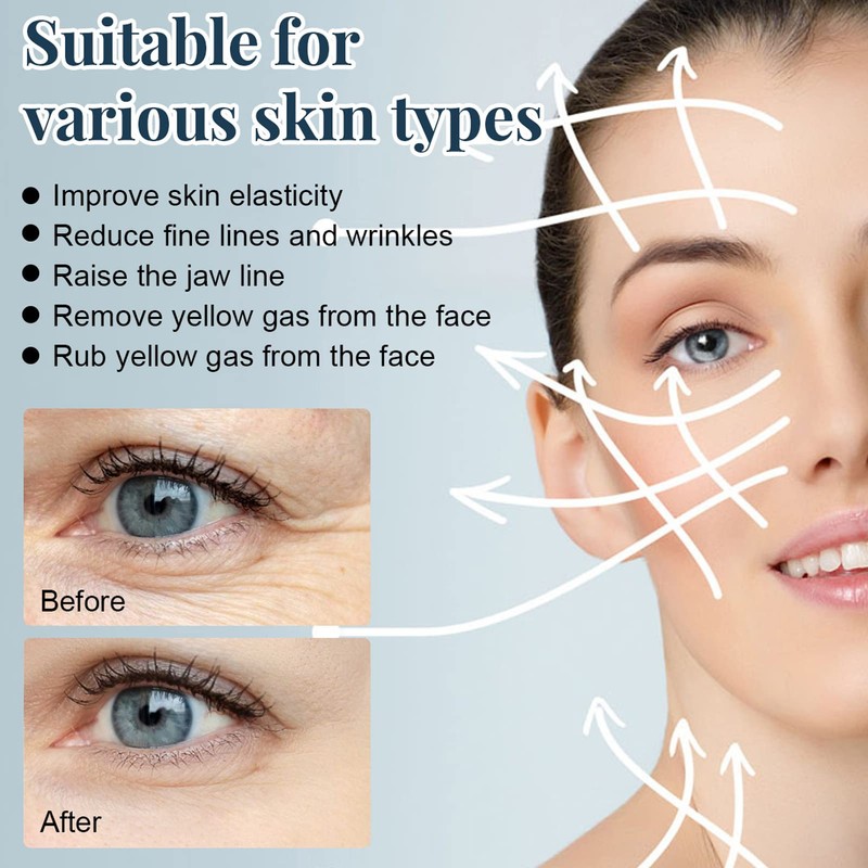 Face Lifting, Collagen Silk Threads, Collagen Silk Threads for Lifting,