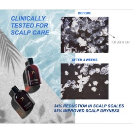 Yashuv Anti-thinning, Anti-Dandruff, Plant-based Surfactant, Glucoside Shampoo - Clinically tested, for Sensitive & Itchy Scalps, Paraben free, SLS free, K-Beauty, 10.14 fl-oz