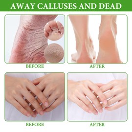 Foot Mask Socks Foot Mask Socks Foot Mask Foot Mask Foot Mask Foot Mask Foot Peel Mask Foot Mask Foot Mask Anti Callus Socks Foot Mask Socks with 2 Hand Masks + 1 Cat Claw Hand Mask