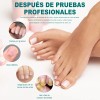 Crema Para Eliminar Hongos En Uñas De Manos , Pies