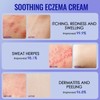 100g Eczema Cream, Skin Soothing Cream, Gentle Barrier Cream