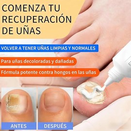 Pomada Reparadora de Uñas, Crema para el Cuidado de las Uñas, Cuidado de Uñas, Fortalece las Uñas, Mejora el Color y Restaura Uñas Dañadas