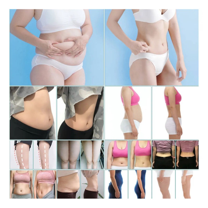 Crema Reafirmante Reductora S-shape Quema Grasa
