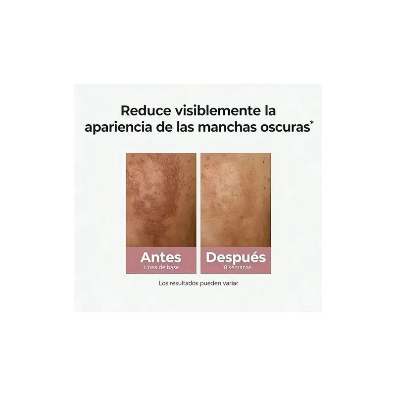 Kit Eucerin Anti-pigment Crema Corporal + Serum Dual