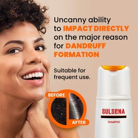Selenium Sulphide Anti Dandruff Shampoo for Men and Women - Active Selenium Formula - Deep Sulfide Cleansing Nourishing Dandruff Shampoo to Relieve Itching by Sulsena - 150 ml