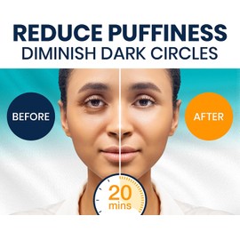 Stylia Parches Debajo de Los Ojos para Ojeras y Ojos Hinchados(30 Pares), Mascarilla de Colágeno Marino para Hinchazón Con Vitamina C, Ácido Hialurónico y Extracto de Perla, Almohadillas de Gel para O