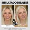 Henrys Polvo para Retocar Raíces Rubio Claro 10g, Define Línea