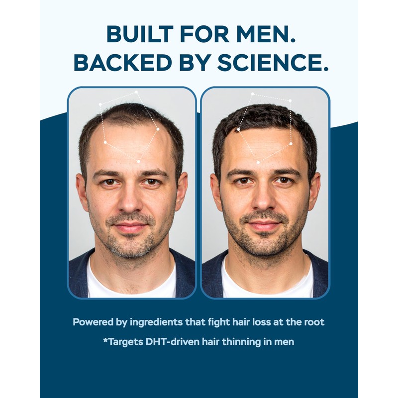 Improved Complex Saw Palmetto for Men & Prostate Health Supplements