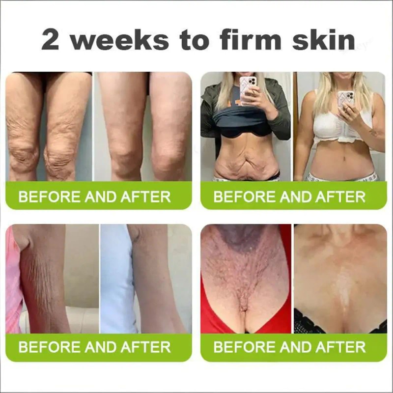 ! ¡crema Firmador Antirrugas Retinol Shot!