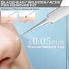 Herramientas para quitar puntos negros y astillas, kit de acné,