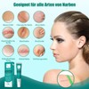 Narbensalbe, Narbengel für C-Sektion, Operationen, Verbrennungen, Keloid,Akne-Reduziert die Sichtbarkeit von