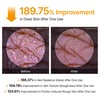 Dr.Melaxin Peel Shot Kojic Acid Turmeric Body Exfoliator Spray 6.76