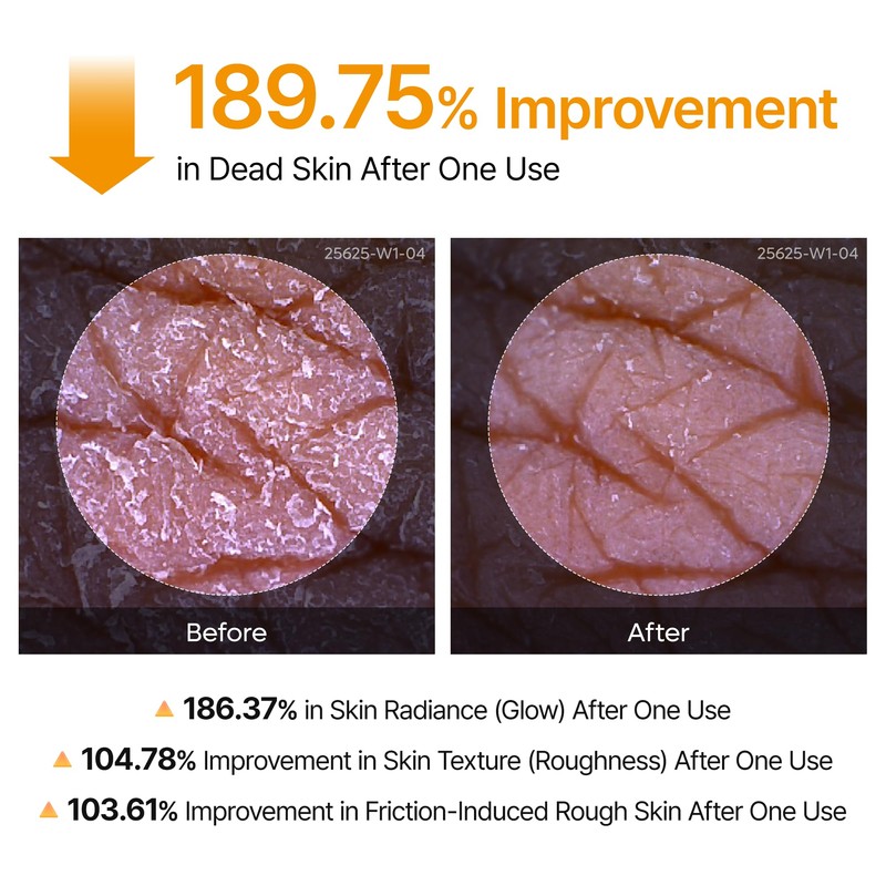Dr.Melaxin Peel Shot Kojic Acid Turmeric Body Exfoliator Spray 6.76