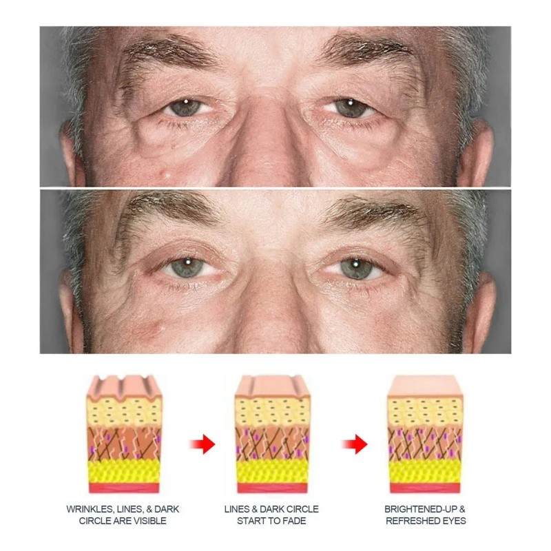 Crema Reparadora Para Ojos Masculinos De 2 Piezas