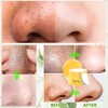 YOUSHEME 2pcs Pore Strips,Deep Cleansing Pore Strips,Nose Plants Blackhead Remover