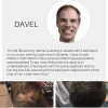 Polvo De Fibra Capilar Negro Cubre Raz De Cabello Calvicie