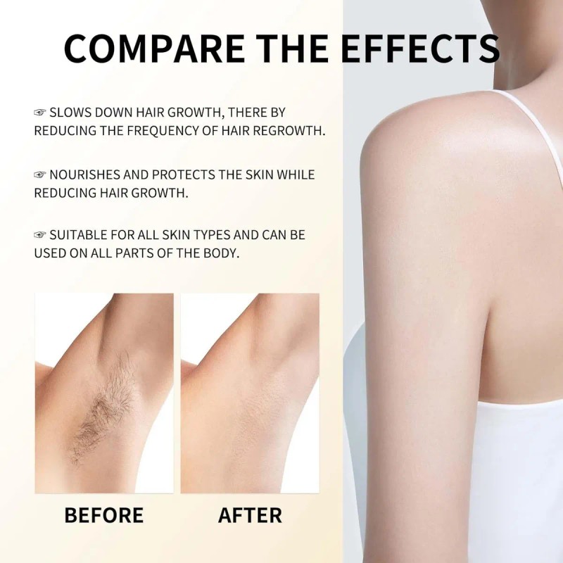 Aceite De Cyperus Rotundus, Depilatorio, Reduce El Crecimien