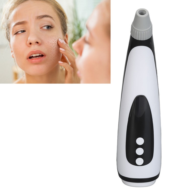 Electric Blackhead Extractor Tool USB Rechargeable Facial Pore Suction Cleaner