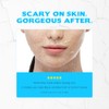 SKIN1004 Zombie Pack