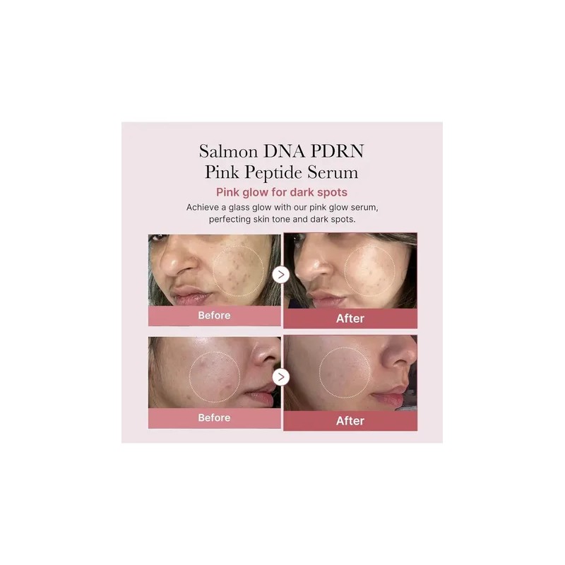 Medicube Pdrn Serum De Peptido Rosa Glow Peptido, Niacinamid